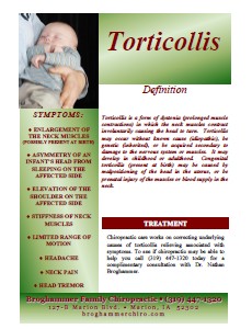 Torticollis